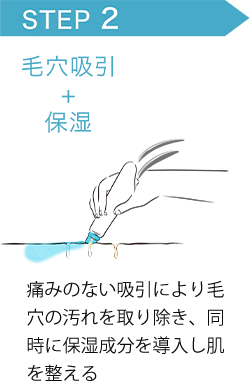 STEP2 毛穴吸引+保湿 痛みのない吸引により毛穴の汚れを取り除き、同時に保湿成分を導入し肌を整える